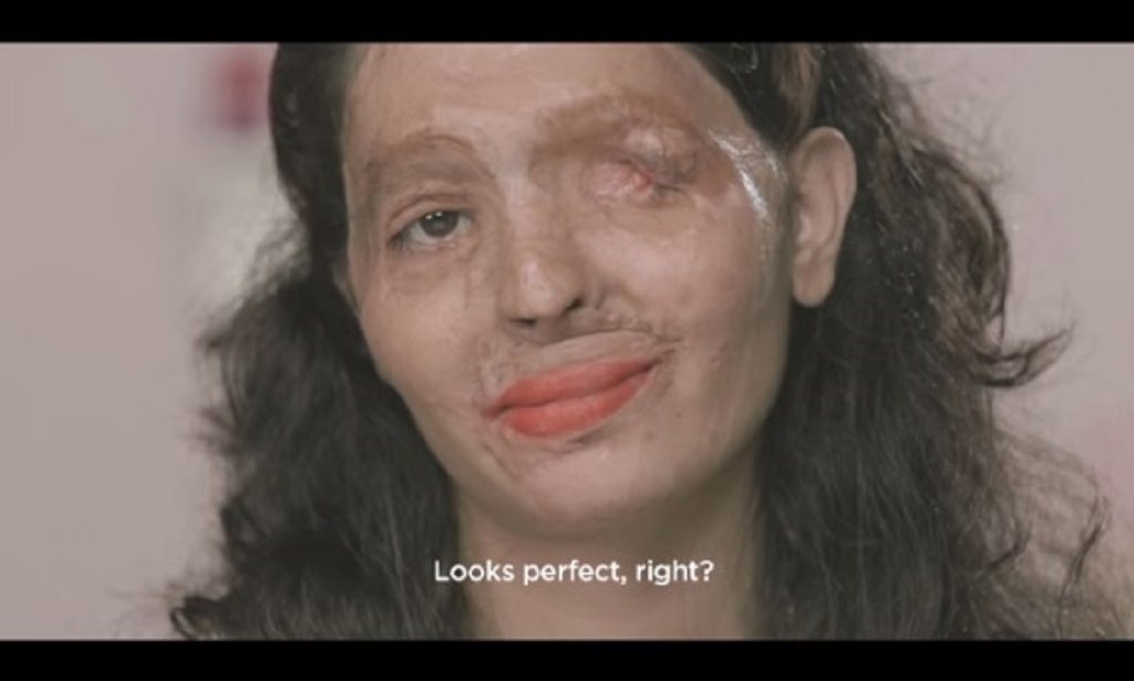 Acid Attack Survivor Shows The World How Easily Available Acid Is Through A Beauty Tutorial