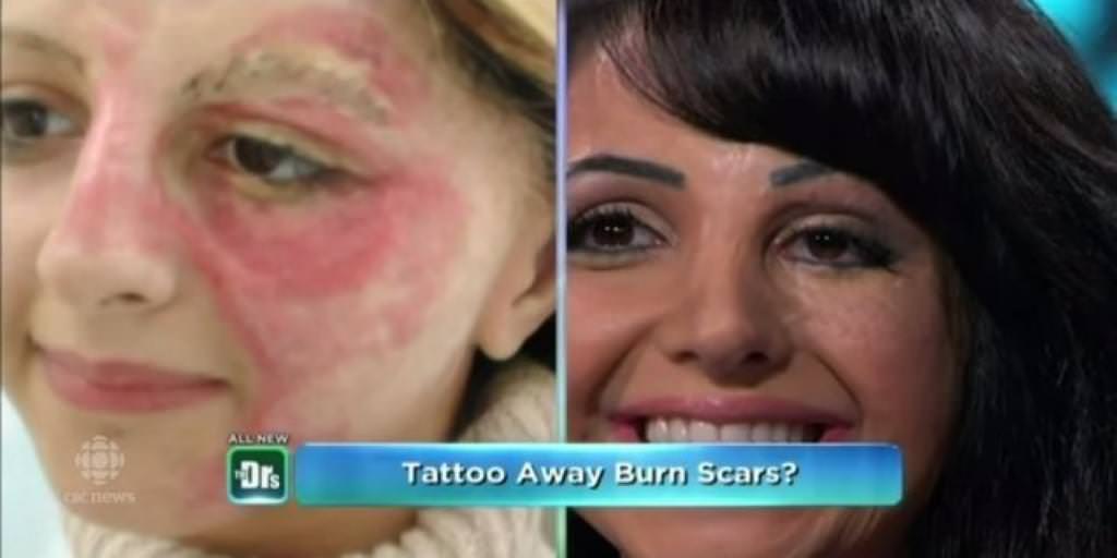 Amazing Tattoo Artist Using Her Skills To Help Burn Victims Regain Their Confidence