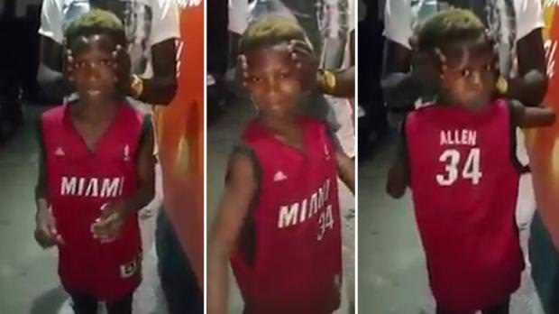 Watch This Kid Naturally Turn His Head 180 Degrees – No I am Not Lying