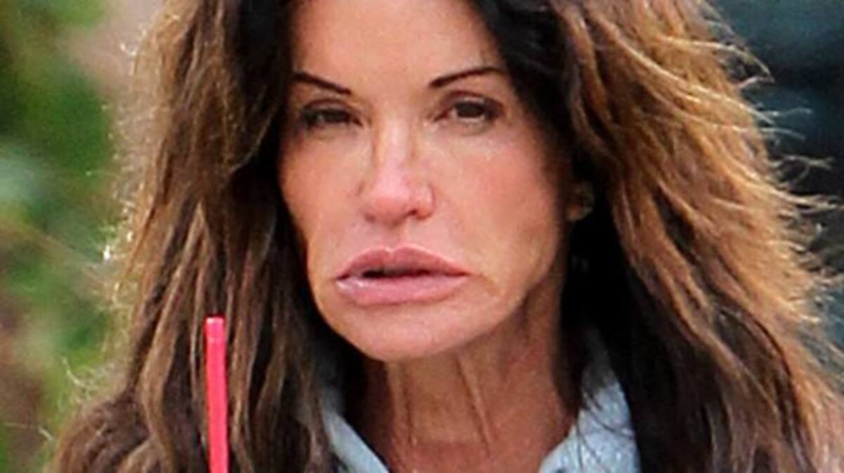 Photos of Top Supermodels Not Looking Their Best 7