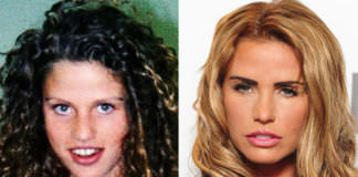 celebs with plastic surgery