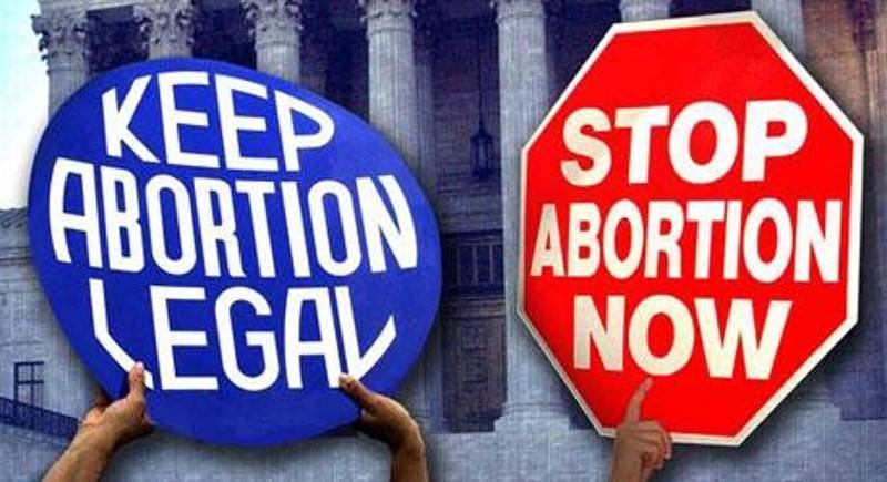 Should Abortion Ever Be Made Illegal? 3